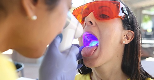 Oral Cancer Screening